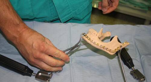 Foto 3Dific chirurgia maxillofacciale