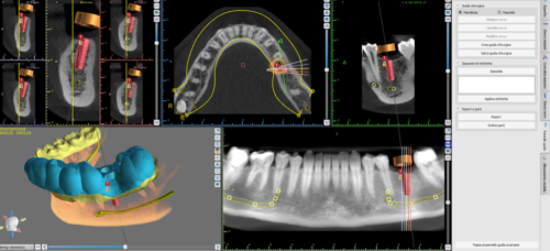 Foto 3Dific odontoiatria